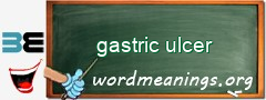WordMeaning blackboard for gastric ulcer